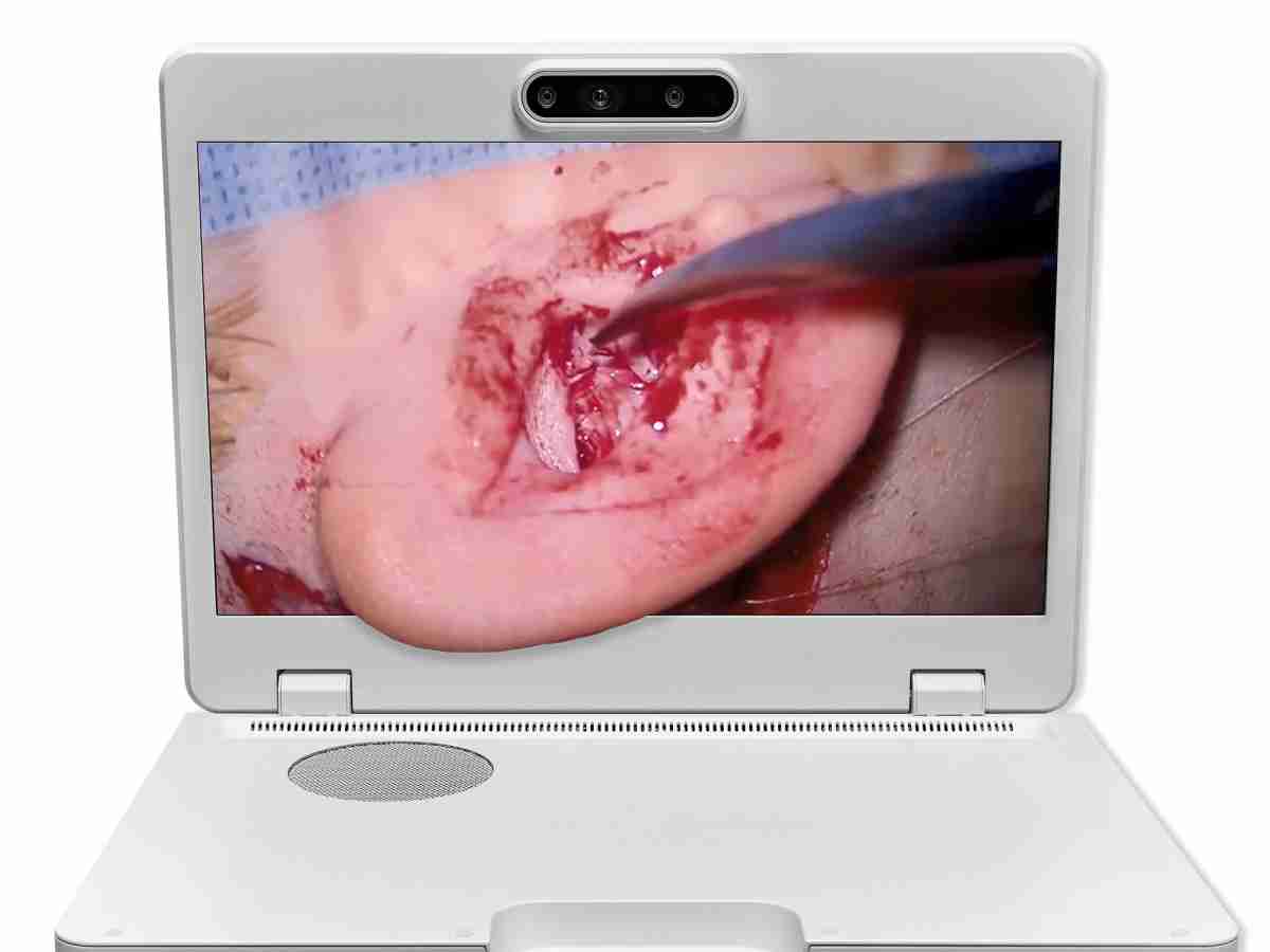 达擎之＂Heads-up 3D显微手术显示系统＂，，，整合4K裸眼3D显示及眼球追踪系统，，具备快速追踪人眼移动位置功能，，，，减轻医师长时间维持固定姿势的负担，，，，让医师能有更宽广清晰的3D立体视野及更舒适的姿势来执行手术。。